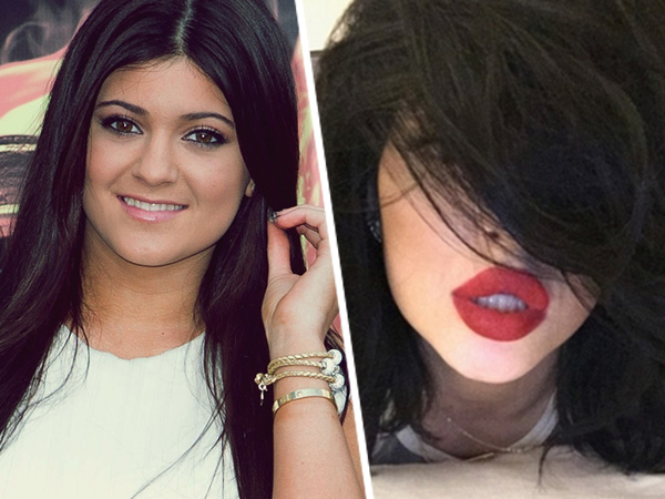 Bibir Tebalnya Dikritik dan Disebut Oplas, Kylie Jenner Kesal