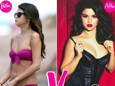 Benar Nggak Sih Selena Gomez Operasi Payudara?