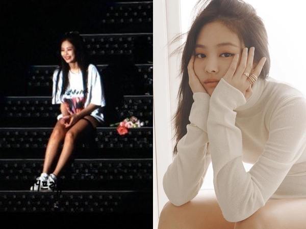 Jennie BLACKPINK Salahkan Dirinya Sendiri Karena Alami Cidera