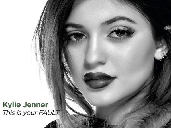 Ingin Tampil Sempurna, Kylie Jenner Akan ‘Rombak’ Wajahnya