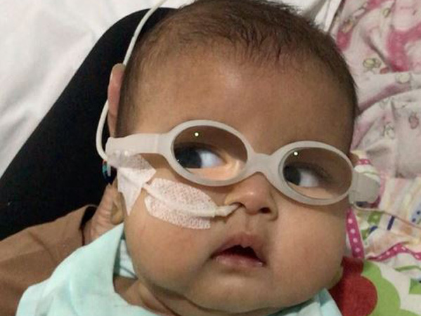Tak Hanya Operasi Katarak, Ini Hal Menyedihkan yang Harus Dilewati Bayi Asri Welas