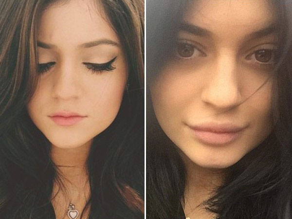 Selalu Bantah Lakukan Injeksi Bibir, Selfie Terbaru Kylie Jenner Ungkap Hal Sebaliknya?