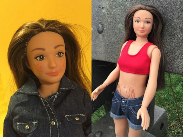 Tak Lagi Langsing, Boneka Barbie Ini Berjerawat dan Punya Selulit!