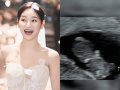 Yuna AOA Hamil Anak Pertama, Ungkap Perasaan Jadi Calon Ibu