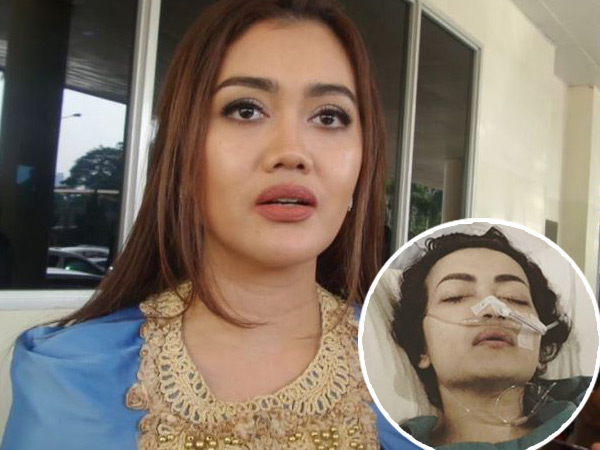 Julia Perez Masuk ICU Lagi, Adik: Tiga Kali Dia Lolos dari Maut