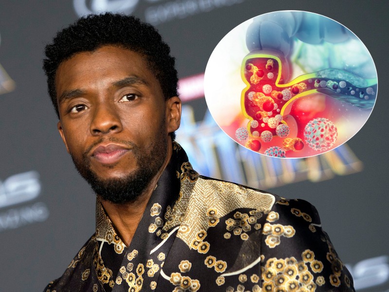 Kenali Kanker Kolon yang Diderita Chadwick Boseman 'Black Panther'