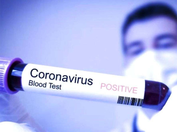 Wali Kota Wuhan Akui Kesalahan Terkait Booming-nya Virus Corona