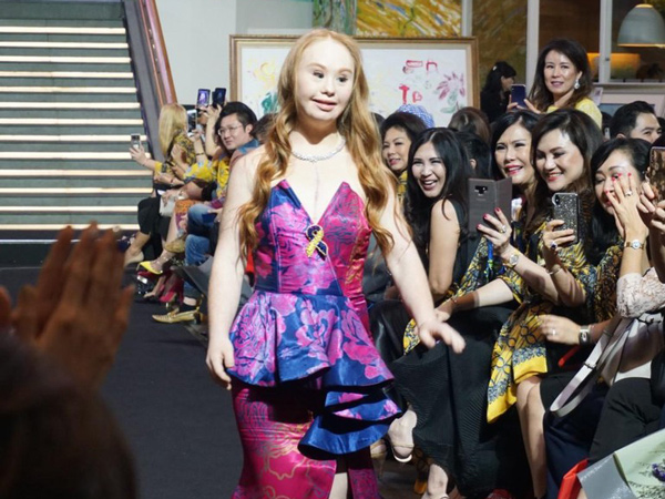 Mengenal Madeline Stuart, Model Down Syndrome Pertama yang Mendunia