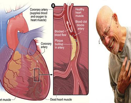 Kondisi Jantung dan Paru Bisa Terlihat dari Darah