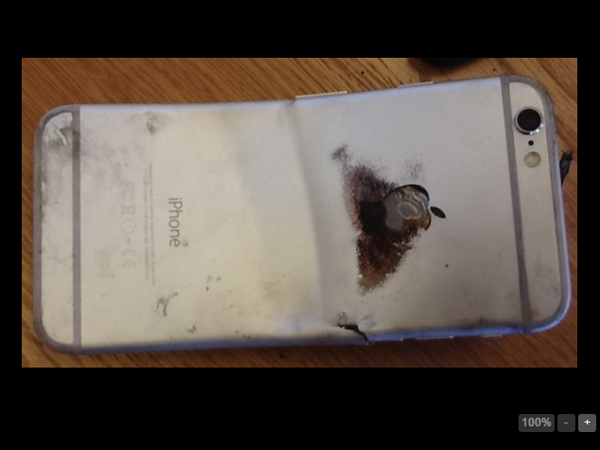 Bengkok, iPhone 6 Ini Terbakar dan Lukai Pemiliknya!
