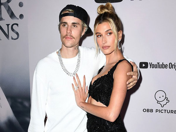 Cara Hailey Baldwin Bantu Justin Bieber Atasi Masalah Jerawat