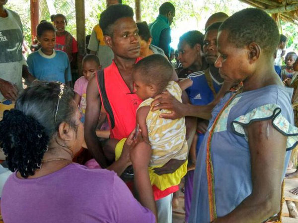 Miris, Puluhan Anak Meninggal dan Ratusan Lainnya Terkena Wabah Campak di Asmat