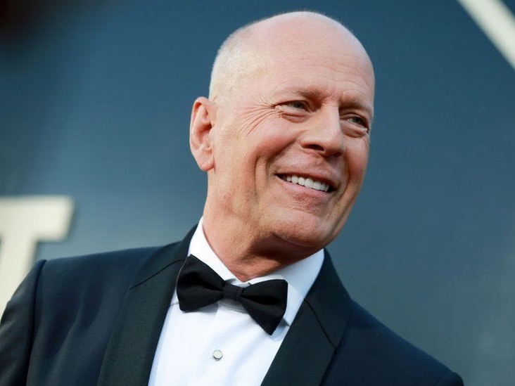 Aktor Bruce Willis Pensiun Akting Akibat Derita Penyakit Afasia