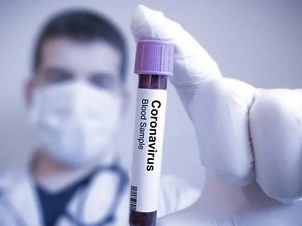 Favilavir, Obat Pertama yang Disetujui Sebagai Penyembuh Dari Virus Corona Untuk Pertama Kalinya