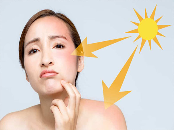 Disarankan Tetap Pakai Sunscreen Walau Cuaca Mendung dan Hujan