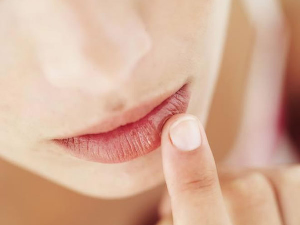 Cek Kesehatan Tubuh dari Kondisi Bibir, Begini Tanda-tandanya