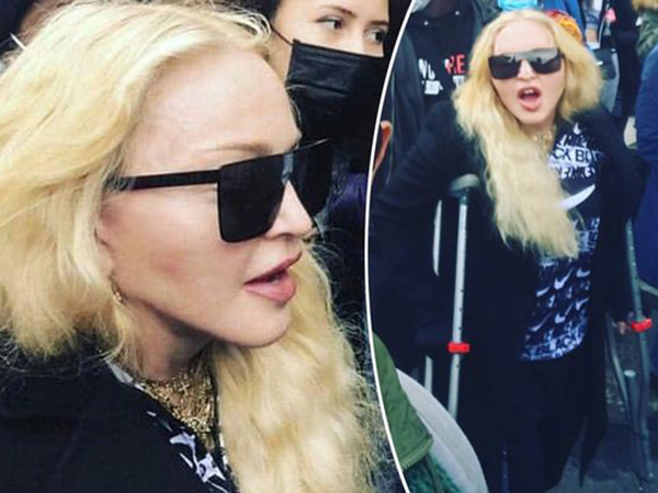 Cedera Kaki, Madonna Tetap Ikut Aksi Protes Kematian George Floyd