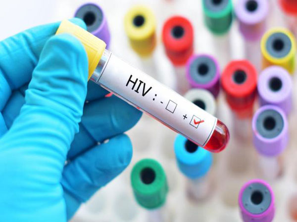 Menurut Studi, Kekebalan Tubuh Tertentu Dapat Melawan HIV