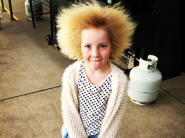 Bikin Gemas, Anak Ini Terlahir dengan Rambut yang Unik