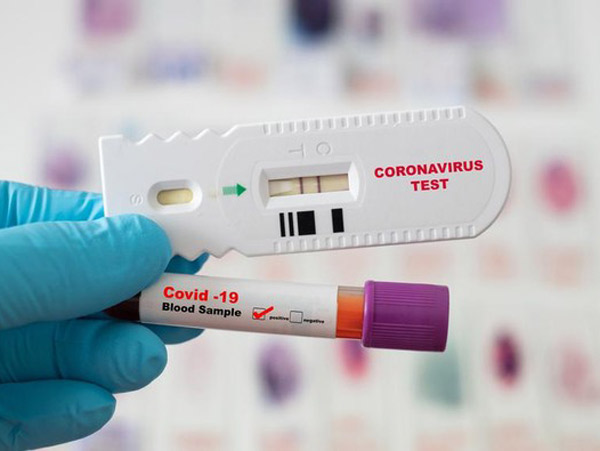 Kini Wajib, Apa Sih Bedanya Tes Rapid Antigen COVID-19 dengan PCR?