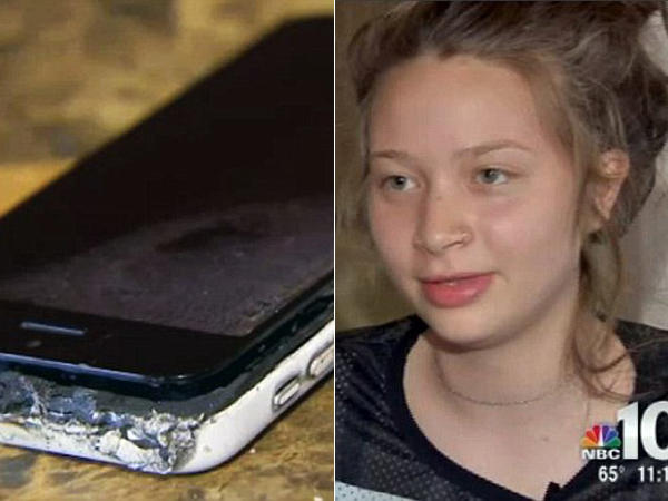 iPhone 5C Meledak, Bokong Gadis Ini Terluka