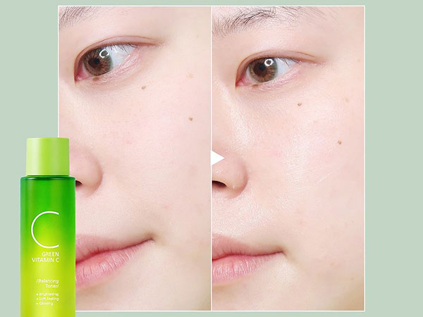 Solusi Efektif Cerahkan Wajah dan Kurangi Dark Spot, Aman untuk Kulit Sensitif!