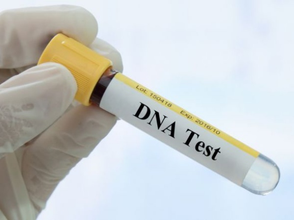 Manfaat Tes DNA Selain Untuk Membuktikan Silsilah Keturunan