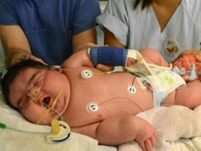 Jasleen Bayi Raksasa yang Lahir Secara Normal