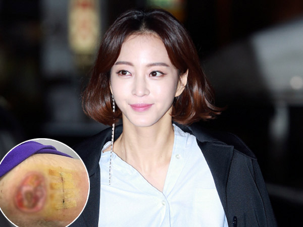 Han Ye Seul Unggah Foto Terbaru Luka Menganga Akibat Malpraktik, Makin Ngeri!