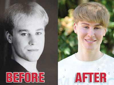 Wow, Pria Ini Terobsesi Ubah Wajah Hingga Mirip Justin Bieber!