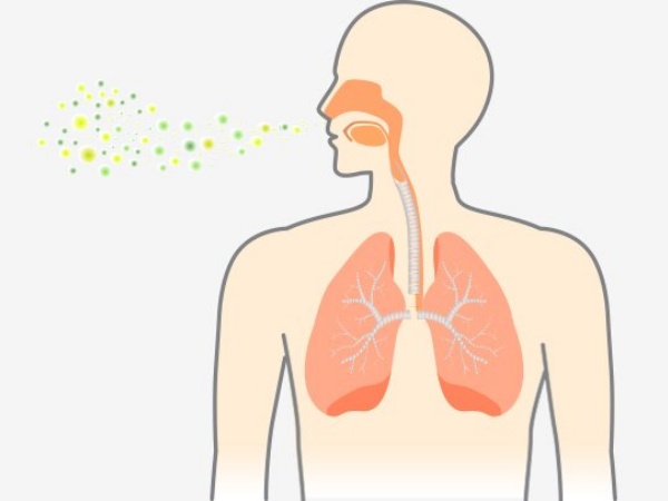 Imbauan Kemenkes RI Soal Wabah Pneumonia 'Misterius' di China