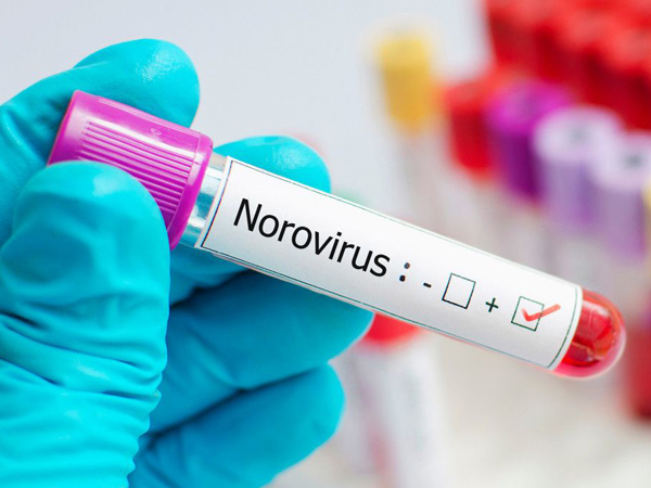 Heboh Wabah Norovirus di China, Juga Ditemukan di Indonesia?
